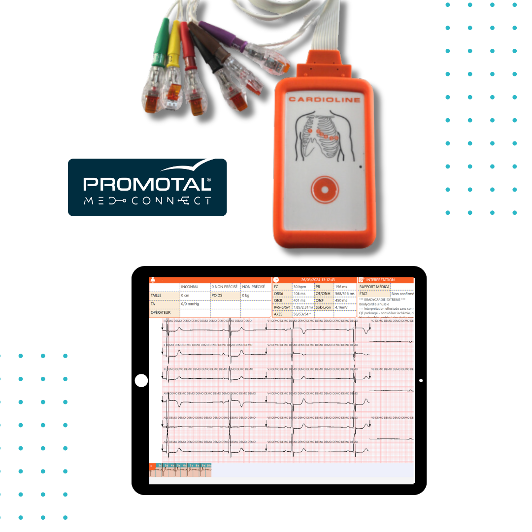 Promotal MedConnect Connected 12-Lead ECG
